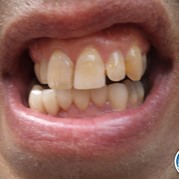 32) GPS Moordspel Maastricht