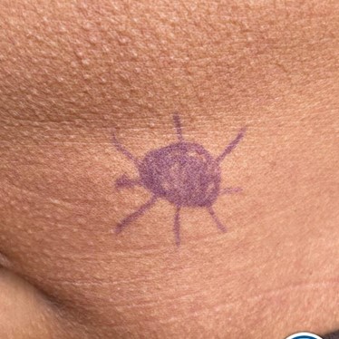 Gooische vrouwen met begeleiding op afstand  (Eigen locatie)